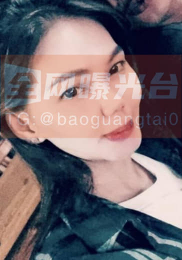 此女的是在星际酒吧认识的，当时一冲动就没带套。回去后大约7天也就是一个...